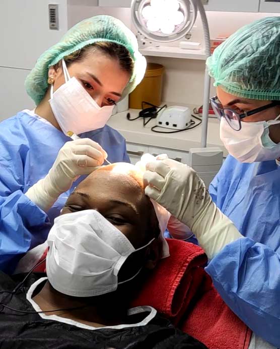 New - Afro Hair Transplant in Turkey