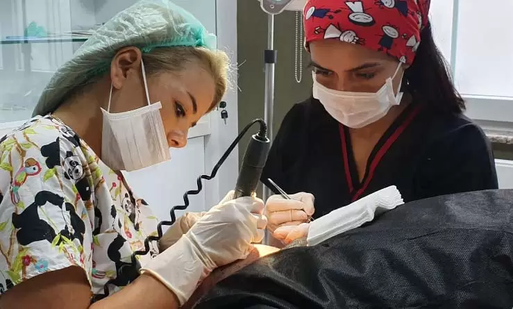 what is hair transplantation