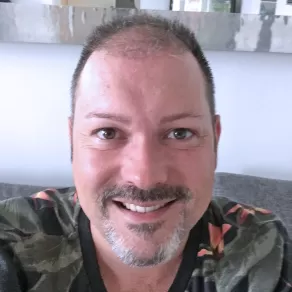 Greffe de Cheveux Avant et Après MORTEN 2MONTHS