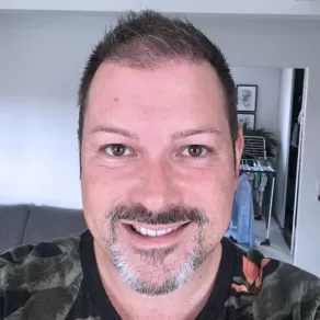 Greffe de Cheveux Avant et Après MORTEN 4MONTHS