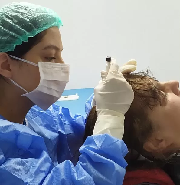 DHI Hair Transplant Turkey What is a DHI Hair transplant